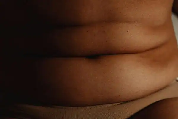 The Hidden Connection: How Stress Shapes Your Fitness and Body Composition 3 image of what stress can do on the stomach area and how Lipo 360 Coventry can help to change your body shape.
